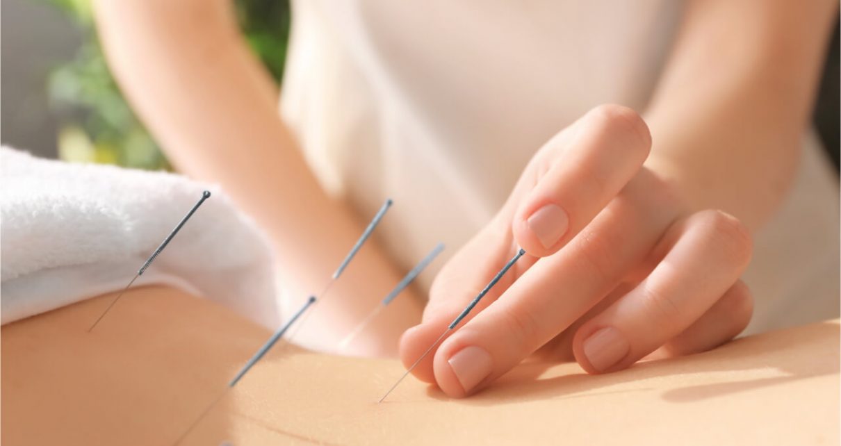 acupuncture points for anxiety